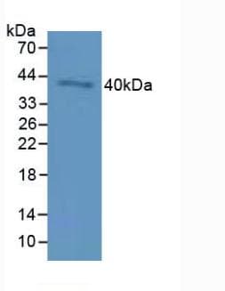 CD72 Antibody (aa169-359)