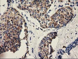 Monoclonal Mouse anti-Human P5CR2 / PYCR2 Antibody (clone OTI4B7, IHC, WB)