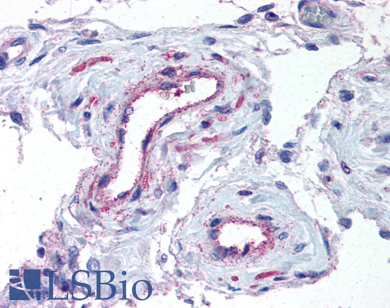 IHC-plus™ ADAMTS1 Antibody (N-Terminus)