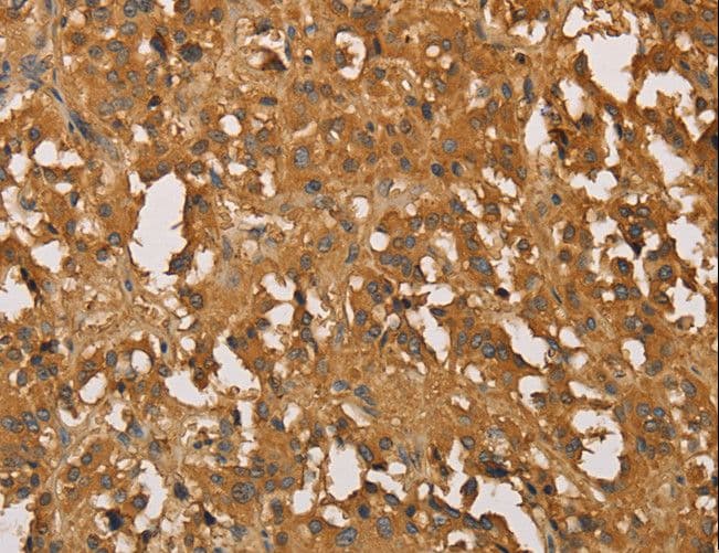 SETD2 Antibody