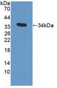 APOC3 / Apolipoprotein C III Antibody (aa21-99, PE)