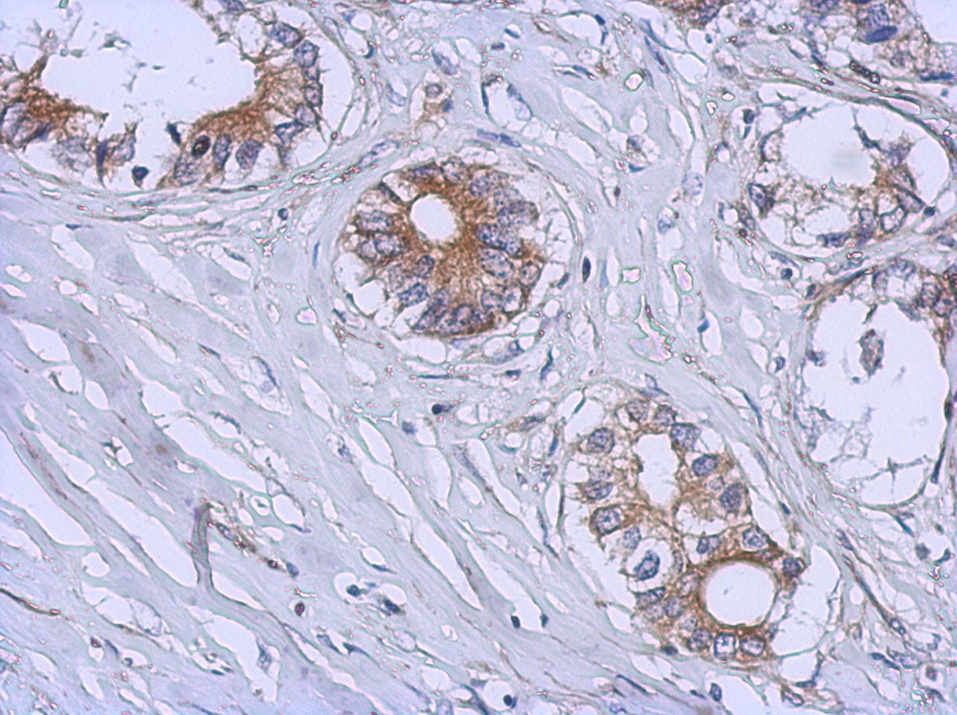 GALT4 / B3GALT4 Antibody