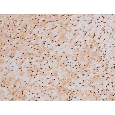 STAT3 Antibody (phospho-Tyr705)