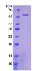 Human HTRA1 Protein (Recombinant His-GST)