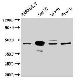 MAP2K4 / MKK4 Antibody (aa2-397)