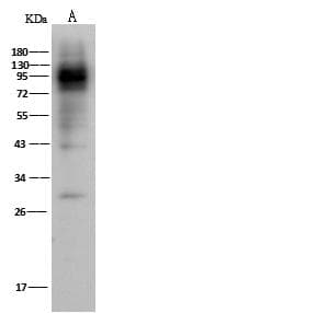 Polyclonal Rabbit anti-Human CD119 / IFNGR1 Antibody (Preservative Free, IHC, WB)