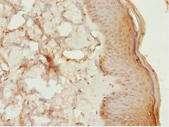 LHX6 Antibody