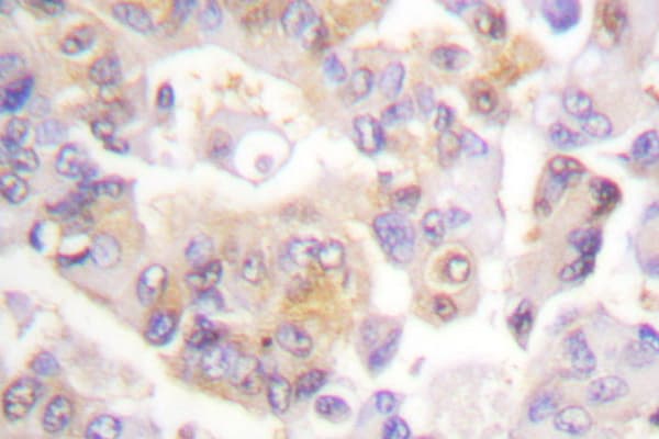 Polyclonal Rabbit anti-Human VAV1 / VAV Antibody (Ala168, IHC, WB)