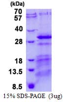 Human Vps60 / CHMP5 Protein (Recombinant His)