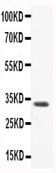 CCL3 / MIP-1-Alpha Antibody (aa24-92)