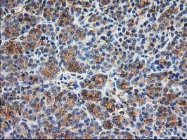 Monoclonal Mouse anti-Human TUBB4 / Tubulin Beta 4 Antibody (clone 6C2, Carrier-free, IHC, IF, WB)
