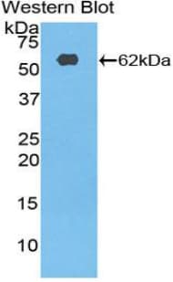RPS6KB2 / S6K2 Antibody (aa194-453)