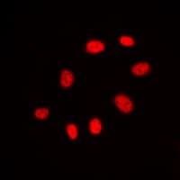 CDC25C Antibody (Internal)