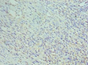 Polyclonal Rabbit anti-Human CD74 / CLIP Antibody (aa137-296, IHC)