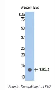 PK2 / PROK2 Antibody (aa29-107, APC)
