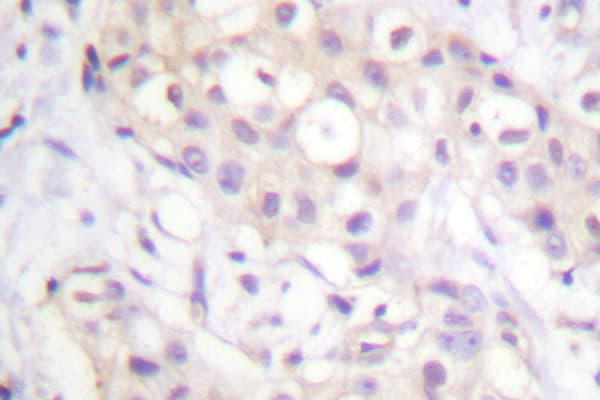 Polyclonal Rabbit anti-Human PKC / Protein Kinase C Antibody (Thr495, IHC, IF, WB)