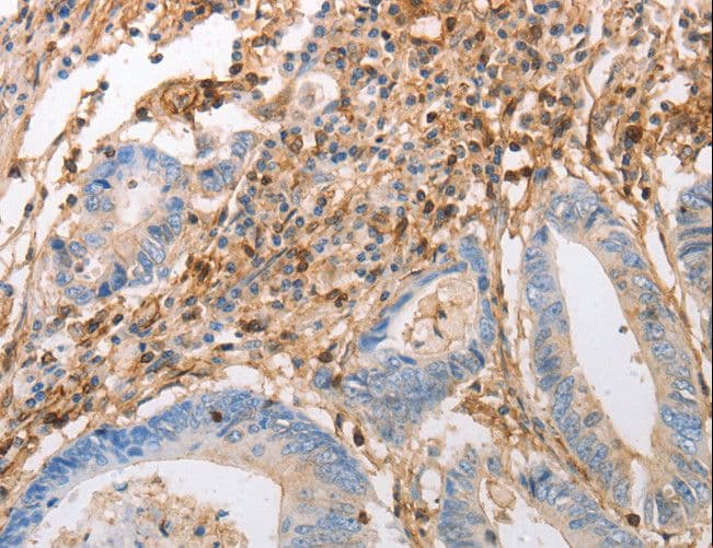 Polyclonal Rabbit anti-Human INA / Alpha Internexin Antibody (IHC, WB)