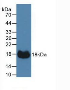 CA12 / Carbonic Anhydrase XII Antibody (aa161-318)