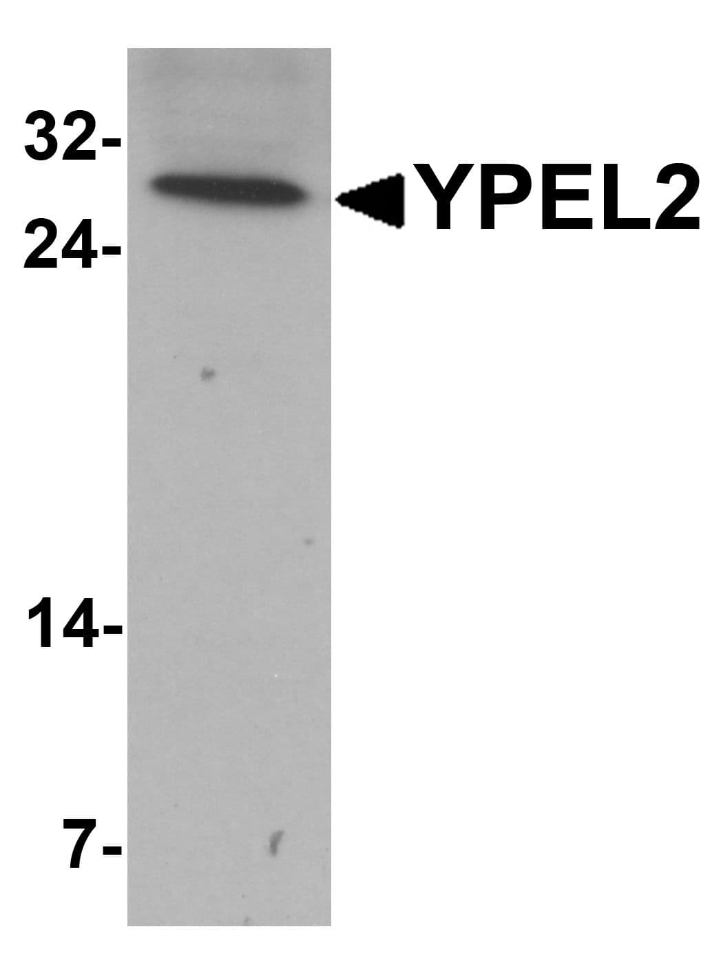 IHC-plus™ Polyclonal Rabbit anti-Human YPEL2 Antibody (IHC, IF, WB)