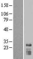 SNRPN Protein (Over-Expression Lysate Myc-DDK (Flag))