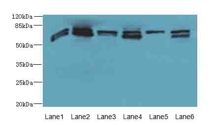 Polyclonal Rabbit anti-Human ZNF555 Antibody (IHC, WB)