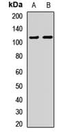 HIRA Antibody