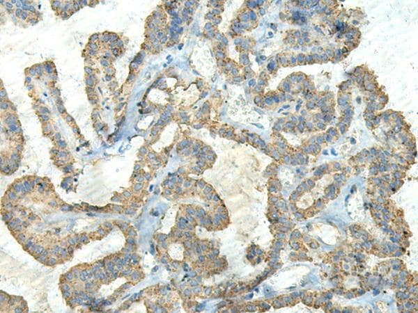 Polyclonal Rabbit anti-Human FCGRT / FCRN Antibody (IHC, WB)