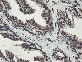 NONO / P54NRB Antibody (clone OTI2C9)