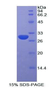 Rat GPT / Alanine Transaminase Protein (Recombinant His)