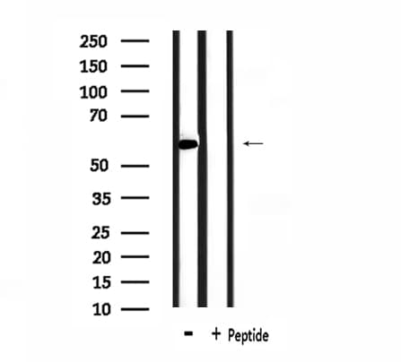 HnRNPLL / HNRPLL Antibody