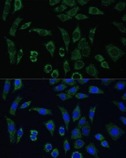 Polyclonal Rabbit anti-Human ACLP / AEBP1 Antibody (IF)