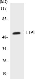 LIPI Antibody (aa272-321)
