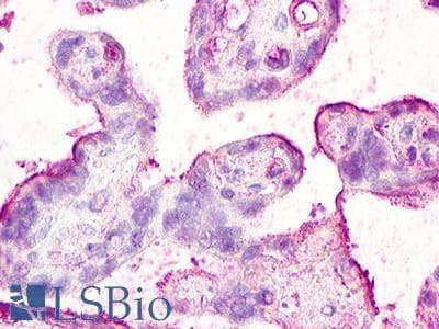 PathPlus™ Polyclonal Rabbit anti-Human ACKR2 / CCR10 / D6 Antibody (N-Terminus, IHC)