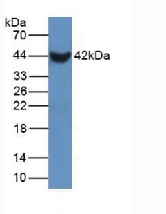 SFTPB / Surfactant Protein B Antibody (aa20-193)