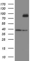 Monoclonal Mouse anti-Human SKIL / SNO / SnoN Antibody (clone OTI3E2, IHC, WB)
