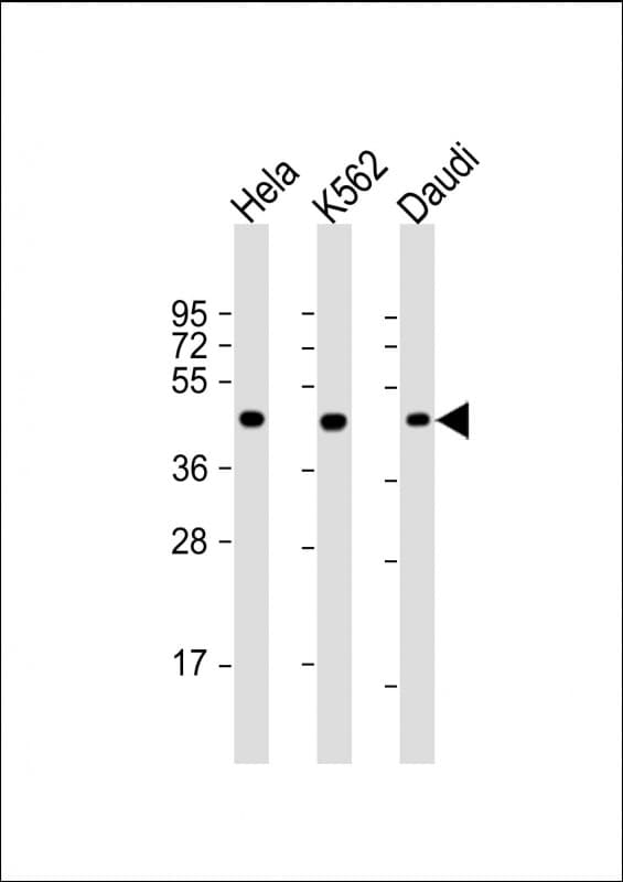 PLIN3 / M6PRBP1 / TIP47 Antibody (clone 1651CT157.85.94)