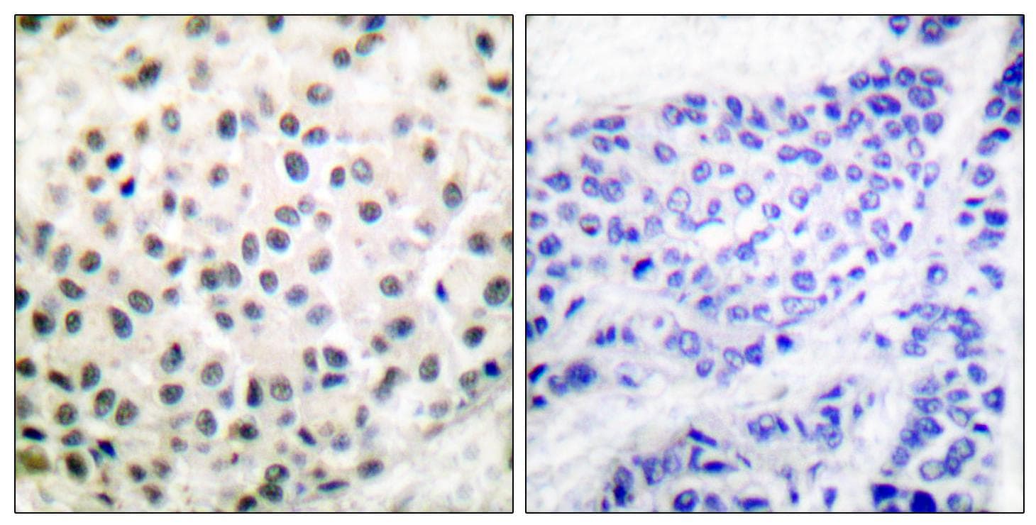 ER Alpha / Estrogen Receptor Antibody (p104/106)