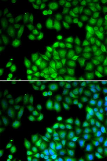 Polyclonal Rabbit anti-Human KMT2E / MLL5 Antibody (IHC, IF, WB)