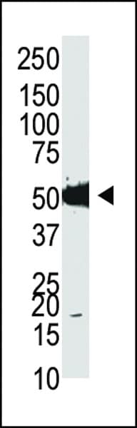 TRDMT1 / DNMT2 Antibody (aa201-230)
