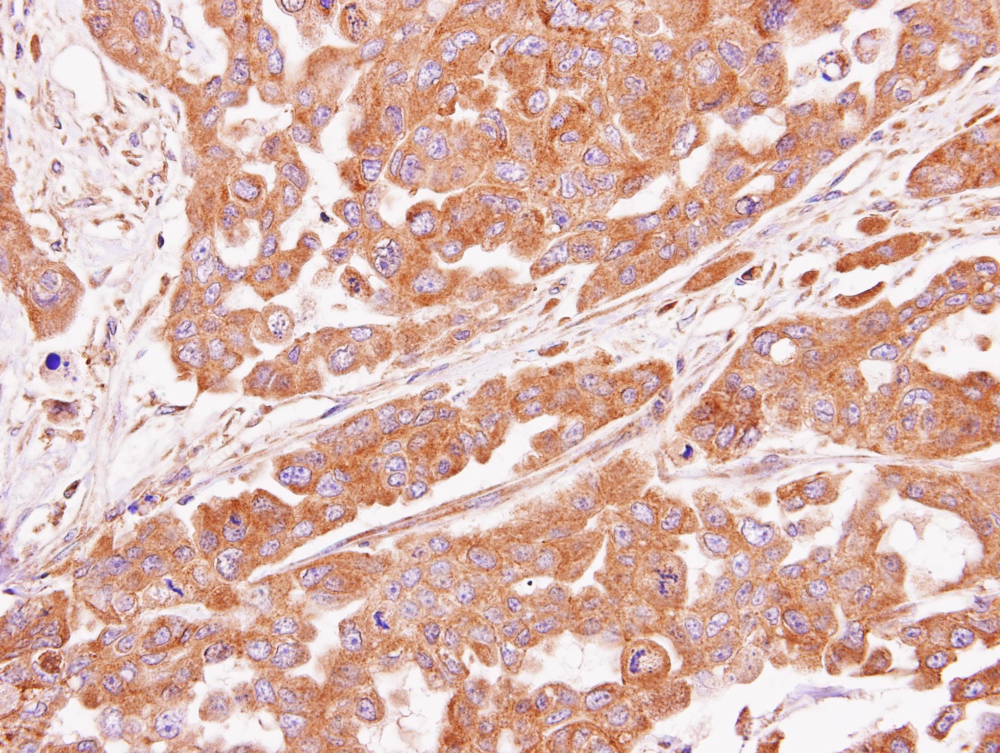 Polyclonal Rabbit anti-Human ASB4 Antibody (aa29-357, IHC, WB)