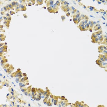 Polyclonal Rabbit anti-Human HRG Antibody (IHC, WB)
