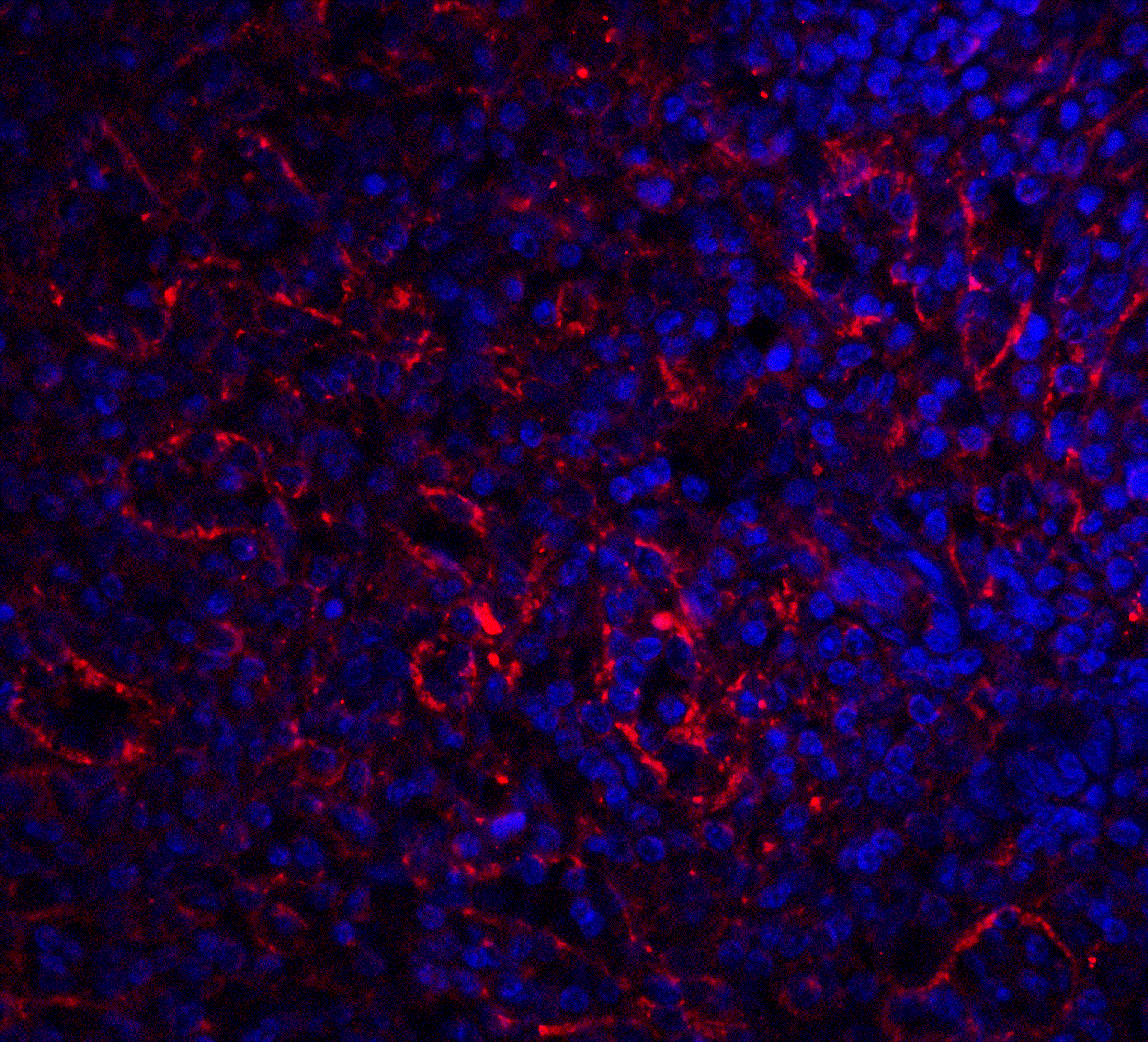 BAFF Receptor / CD268 Antibody