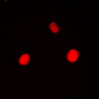 HK1 / Hexokinase 1 Antibody (N-Terminus)