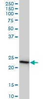IHC-plus™ TC21 / RRAS2 Antibody (clone 2D3-4B8)