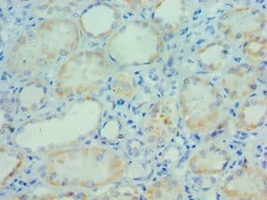 Polyclonal Rabbit anti-Human PARP3 Antibody (aa294-533, IHC, WB)