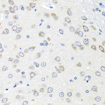PIAS3 Antibody