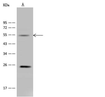 ALDH9A1 Antibody (Preservative Free)