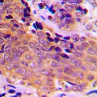 Polyclonal Rabbit anti-Human VASP Antibody (phospho-Ser157, IHC, WB)