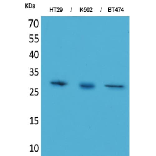 Polyclonal Rabbit anti-Human BRMS1 Antibody (C-terminal, WB)