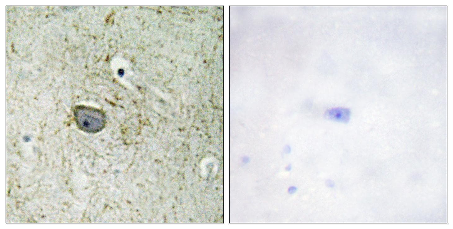 PDGFRA / PDGFR Alpha Antibody